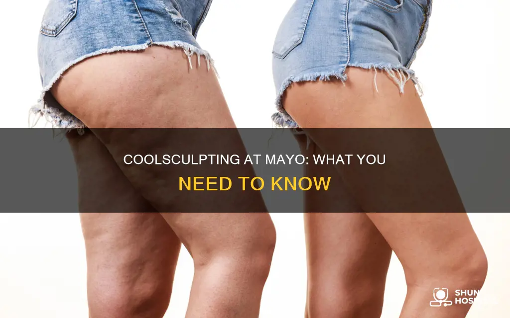 is there cool sculpting at mayo hospital