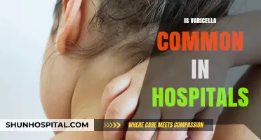 Is Varicella Common in Hospitals? Exploring Prevalence and Prevention Measures