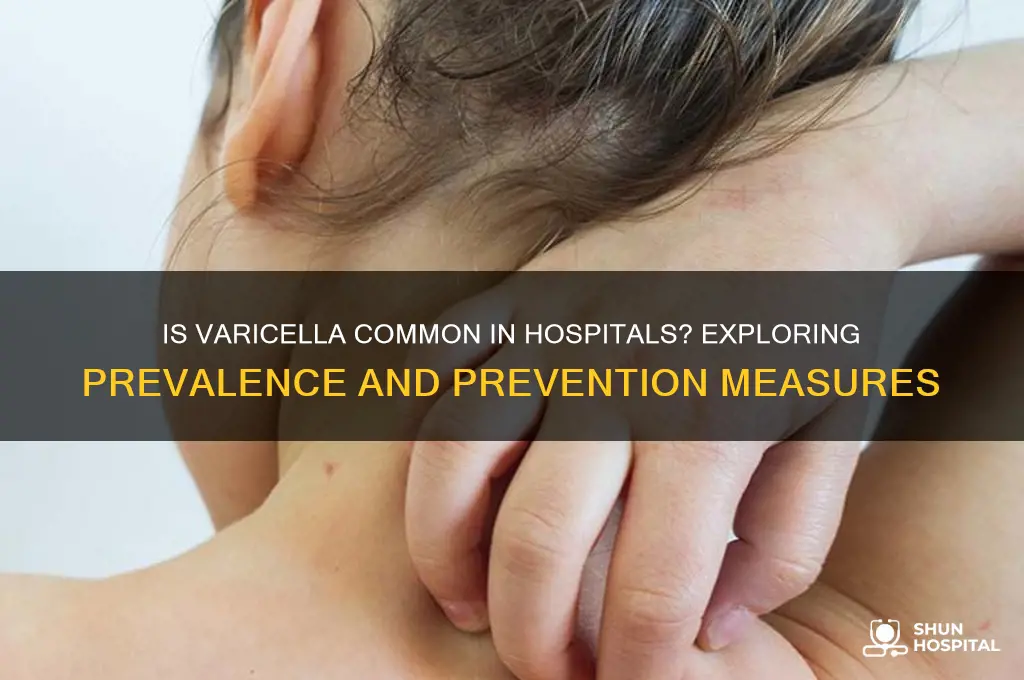 is varicella common in hospitals