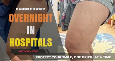 Varicose Vein Surgery: Hospital Stay and Recovery