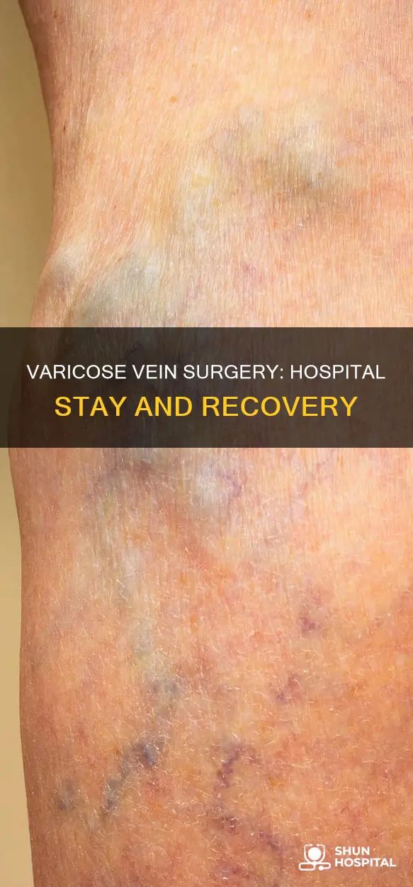 is varicose vein surgery overnight in hospitals
