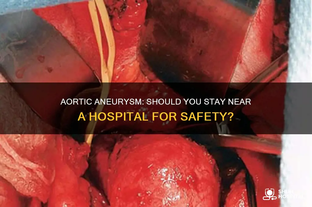 should i stay close to hospital with aortic aneurysm