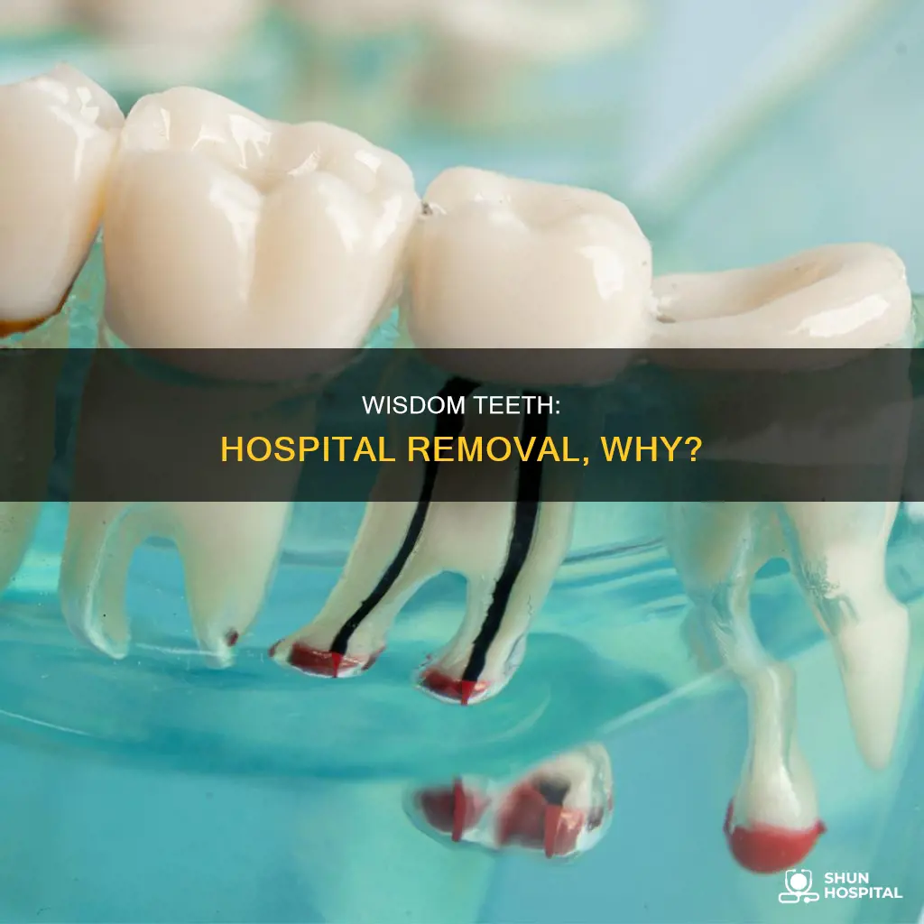 should wisdom teeth be removed in hospital