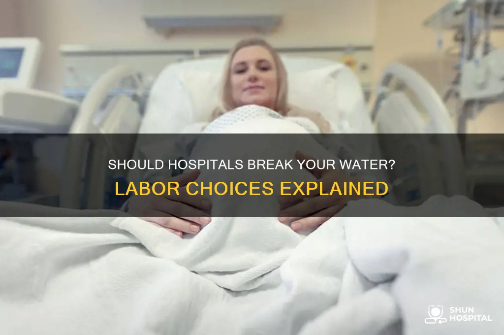should you let the hospital break your water during labor