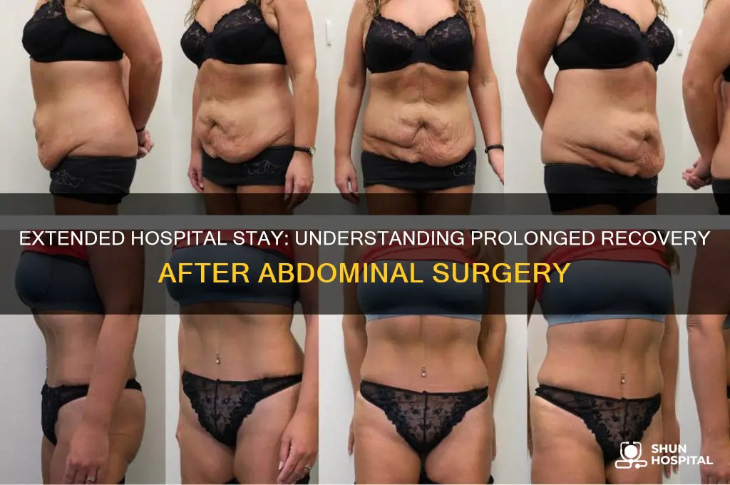 what abdominal surgery are you in hospital for 2 weeks