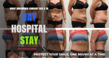 Extended Hospital Stay: Abdominal Surgeries Requiring 10 Days Recovery