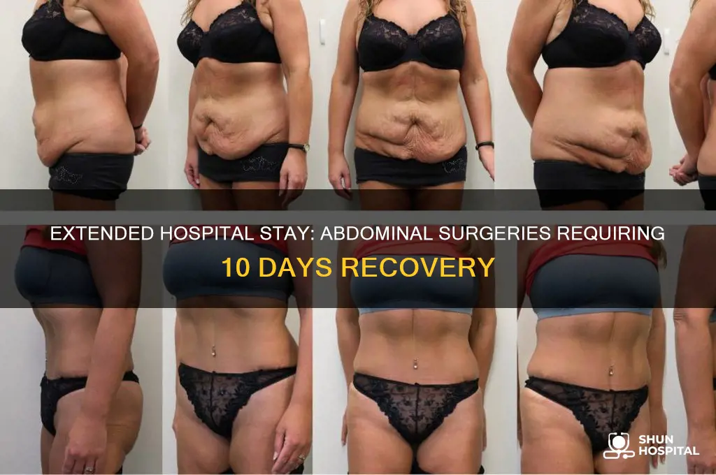 what abdominal surgery has a 10 day hospital stay