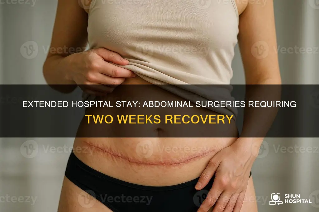 what abdominal surgery would require a 2 week hospital stay