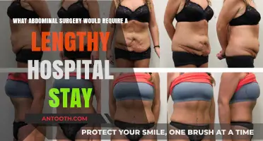 Extended Hospital Stays: Abdominal Surgeries Requiring Prolonged Recovery Time