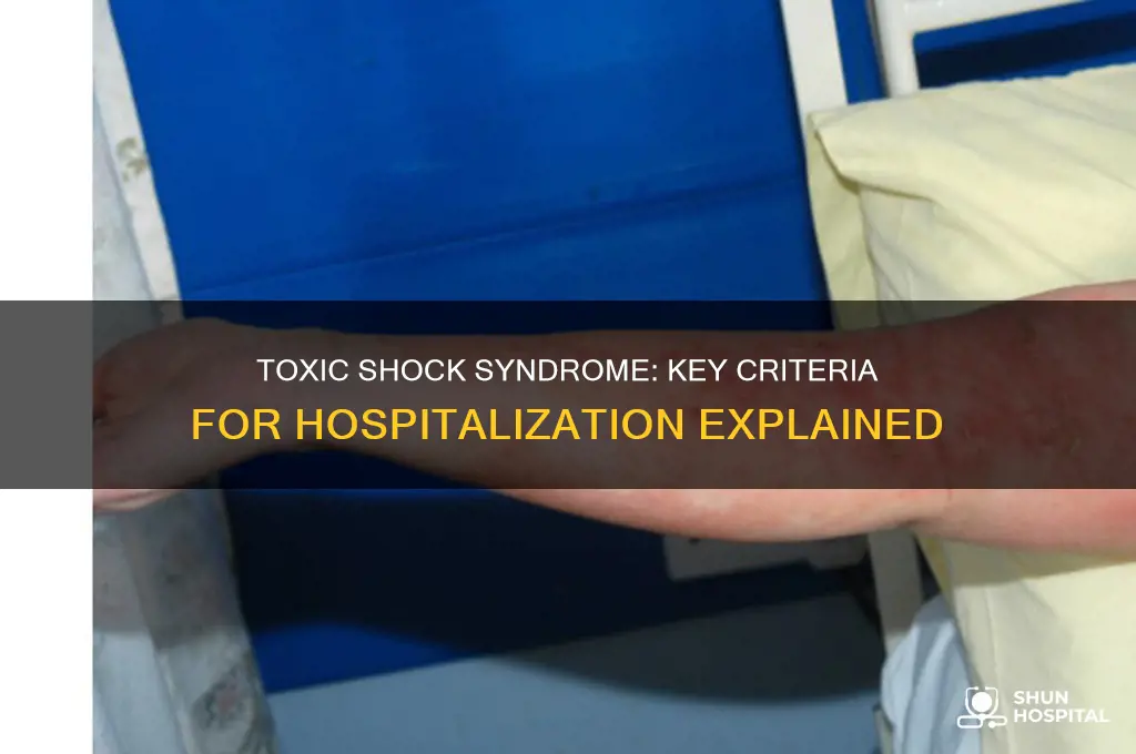 what are criteria to hospitalize for toxic shock syndrome