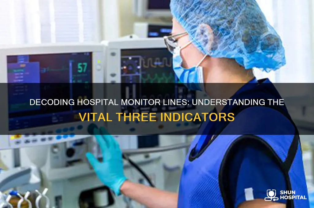 what are the 3 lines on a hospital monitor