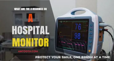 Understanding Hospital Monitor Readings: ECG, Blood Pressure, and Oxygen Levels