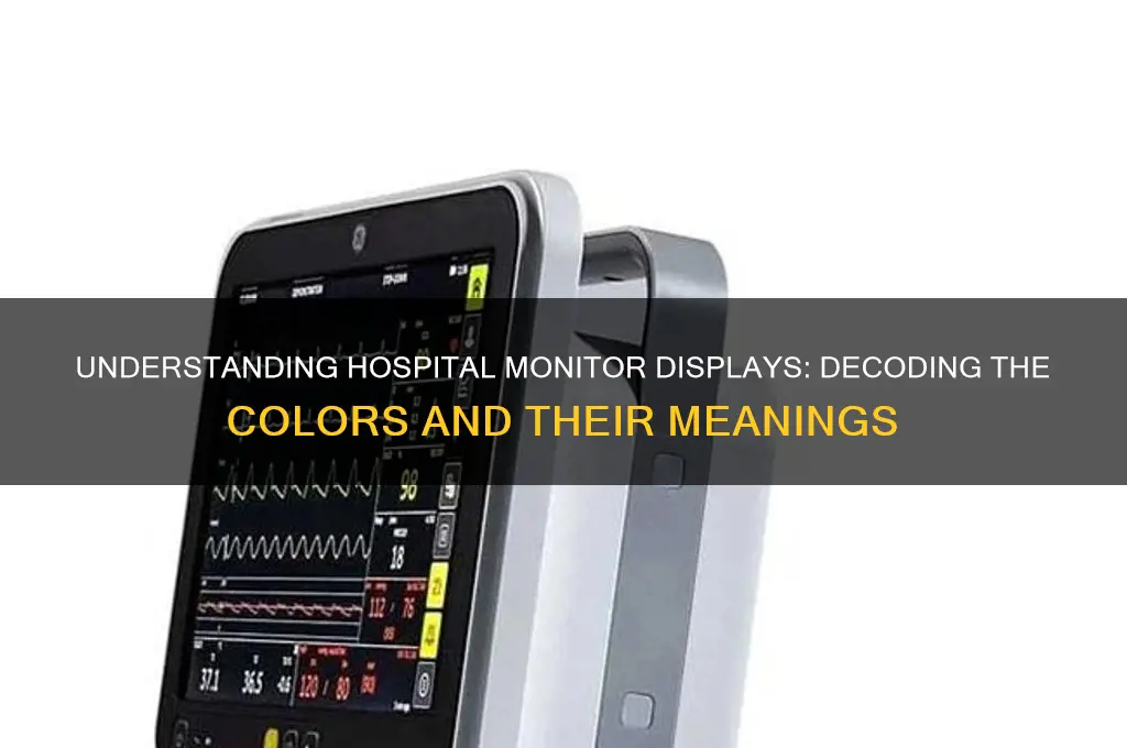 what are the colored displays on a hospital monitor