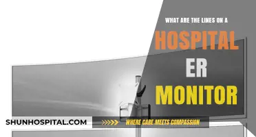 Decoding ER Monitor Lines: Understanding Vital Signs in Hospital Emergencies