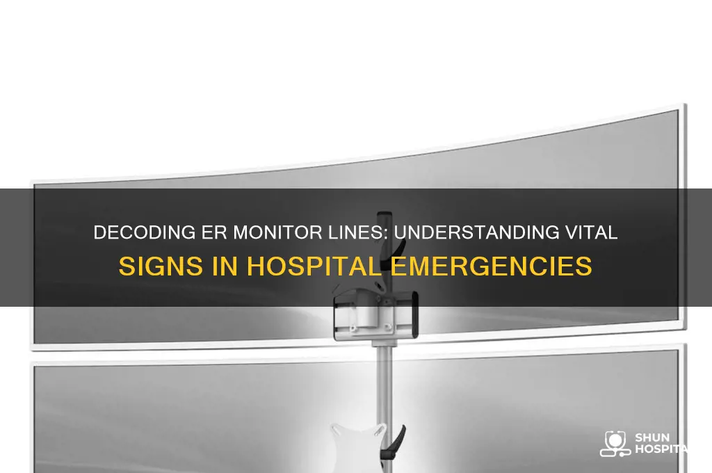 what are the lines on a hospital er monitor