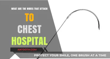 Understanding Chest Wires in Hospitals: Purpose, Types, and Patient Care