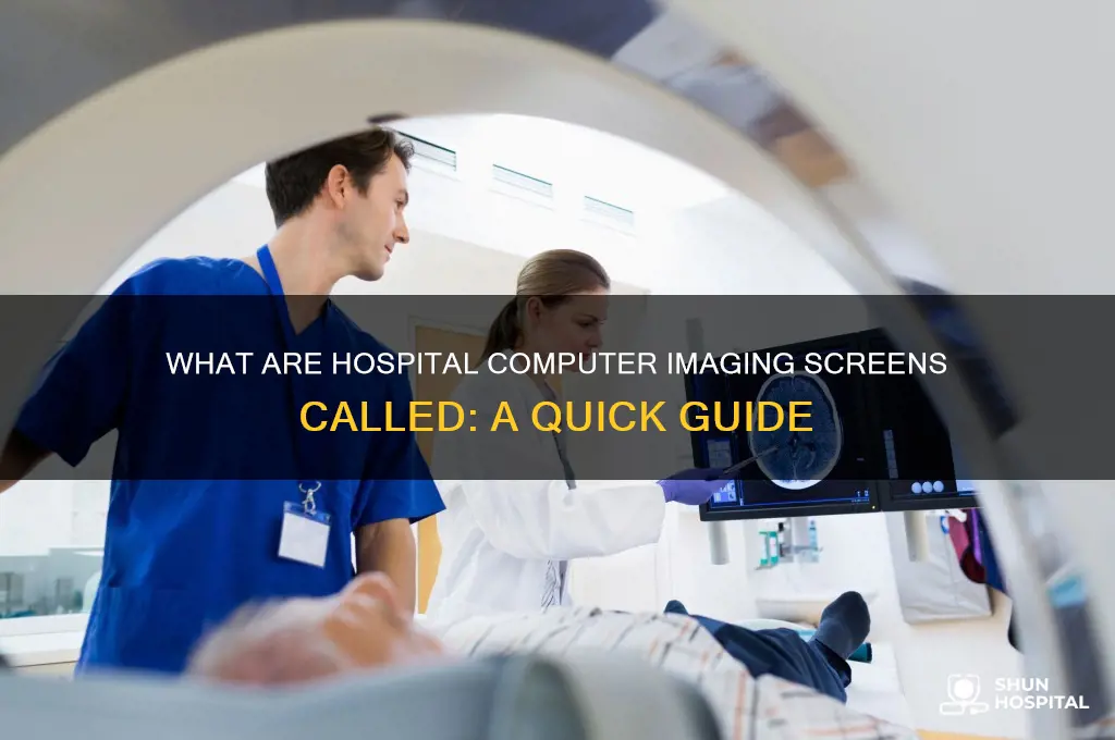 what ate screems called hospital computer imaging screens called