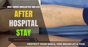 Post-Hospital Swollen Feet and Legs: Causes and Concerns Explained