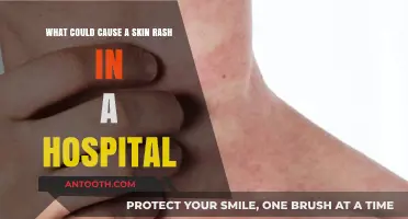 Hospital-Related Skin Rashes: Common Causes and Prevention Tips