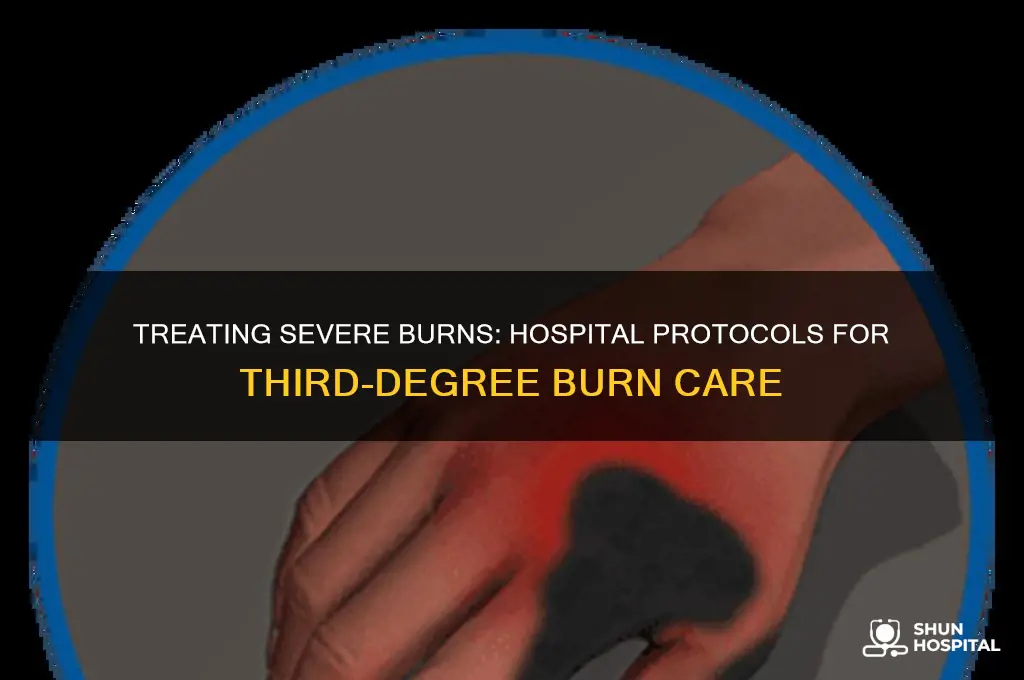 what do hospital do to treat a tired degree burn