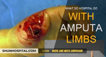 Where Do Amputated Limbs Go After Surgery?