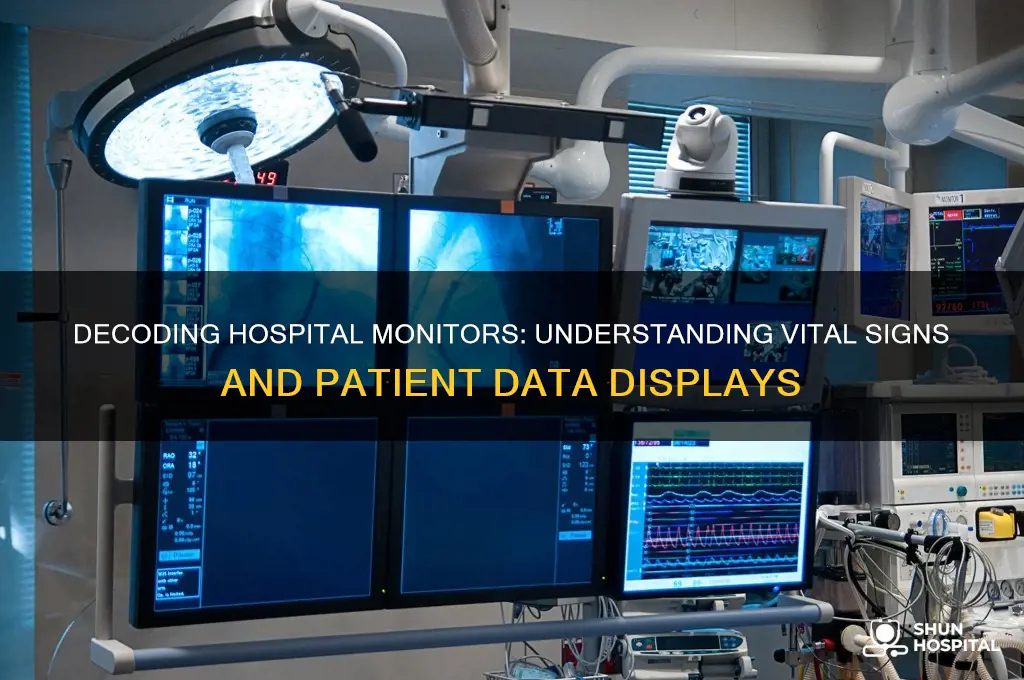 what do hospital monitors read