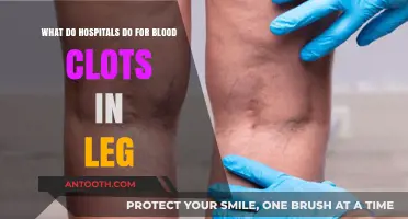 Treating Leg Blood Clots: Hospital Procedures and Emergency Care Explained