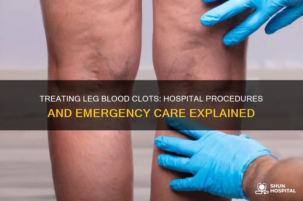 what do hospitals do for blood clots in leg