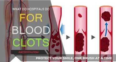 How Hospitals Treat Blood Clots