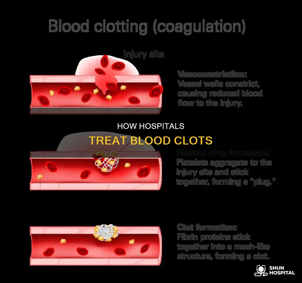 what do hospitals do for blood clots