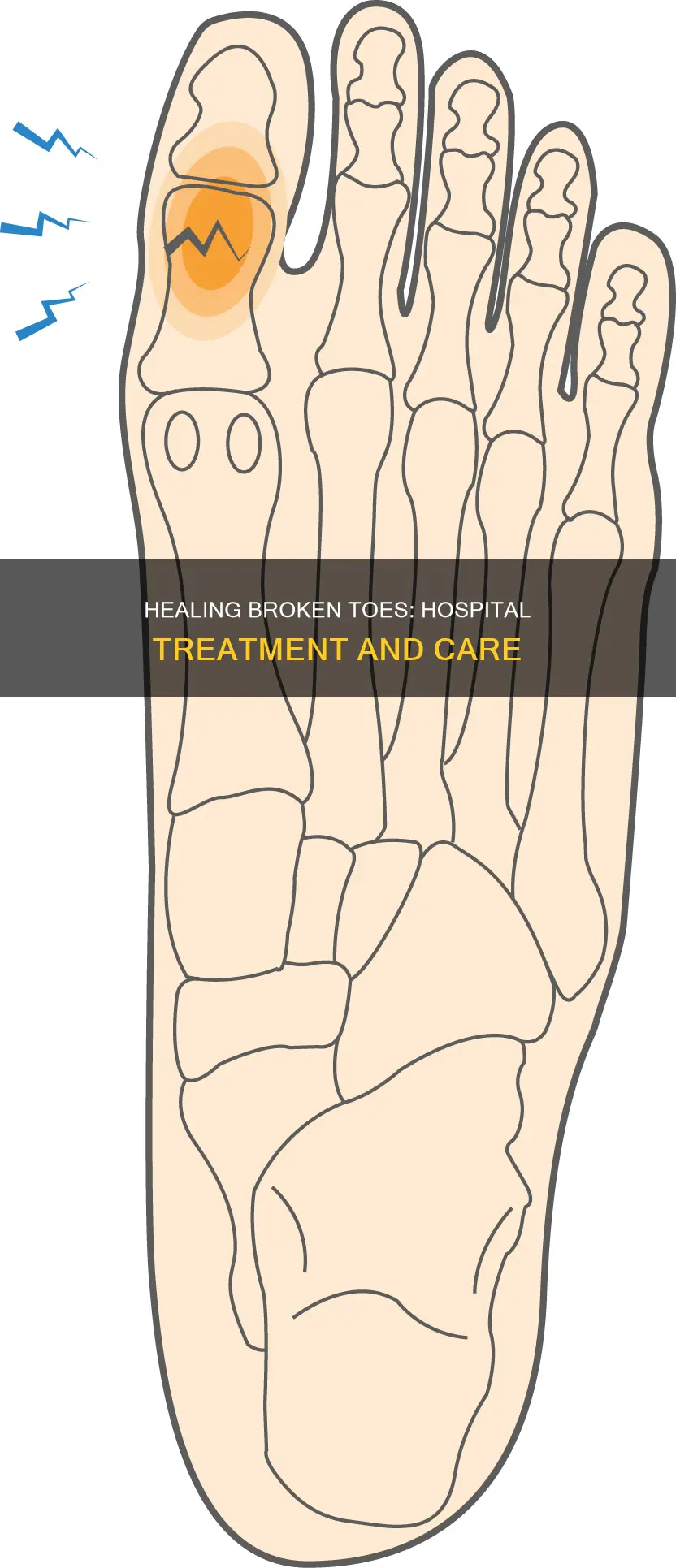 what do hospitals do for broken toes