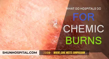 Effective Hospital Treatments for Chemical Burns