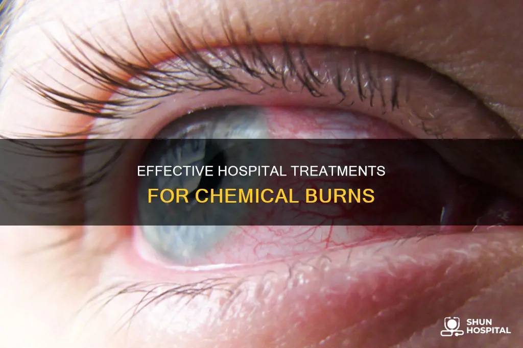 what do hospitals do for chemical burns