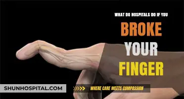 Broken Finger Treatment: What Hospitals Do to Heal Your Injury