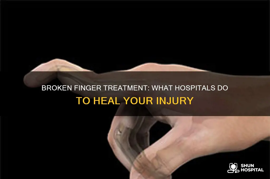 what do hospitals do if you broke your finger