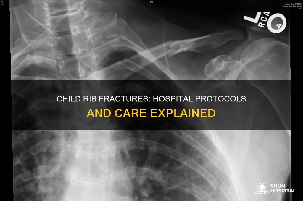 what do hospitals do when a child breaks her ribs