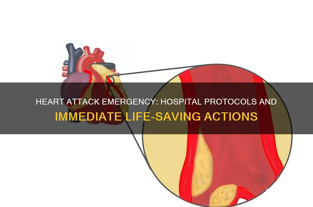 what do hospitals do when you have a heart attack