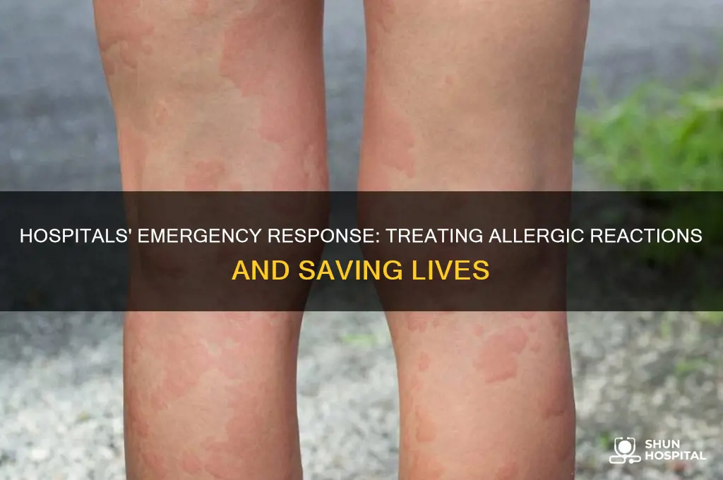 what do hospitals do when you have an allergic reaction