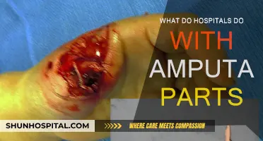 The Fate of Amputated Limbs: Hospital Procedures Explained