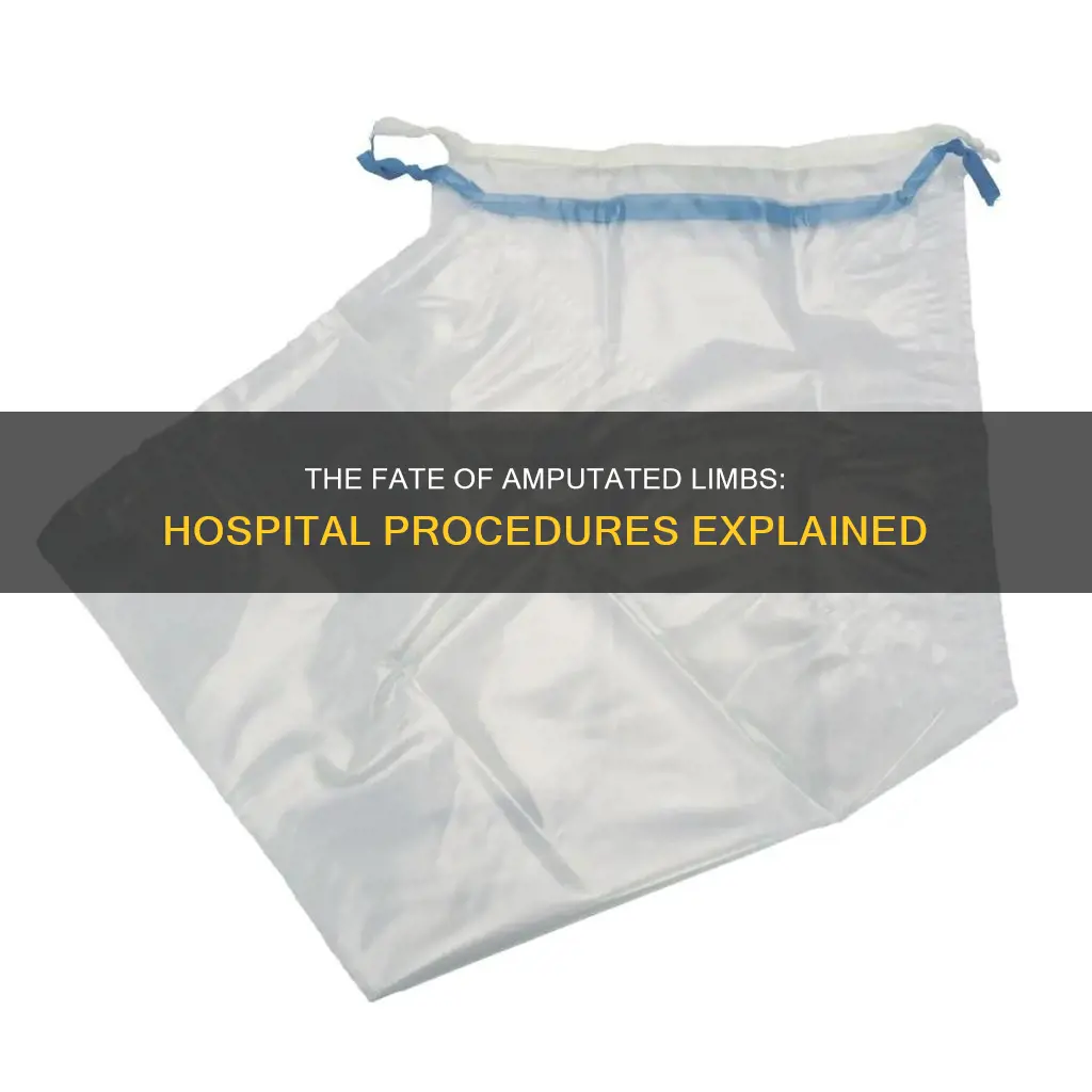 what do hospitals do with amputated parts