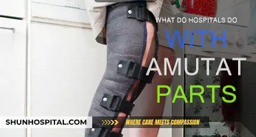 The Fate of Amputated Limbs: Hospital Procedures Explored