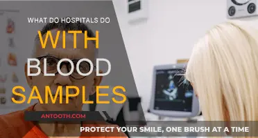 How Hospitals Utilize Blood Samples for Patient Care