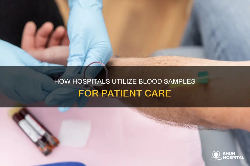 what do hospitals do with blood samples