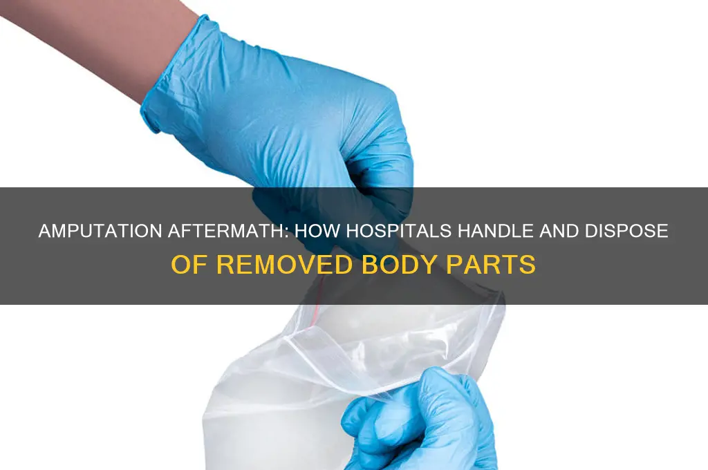 what do hospitals do with body parts after amputation