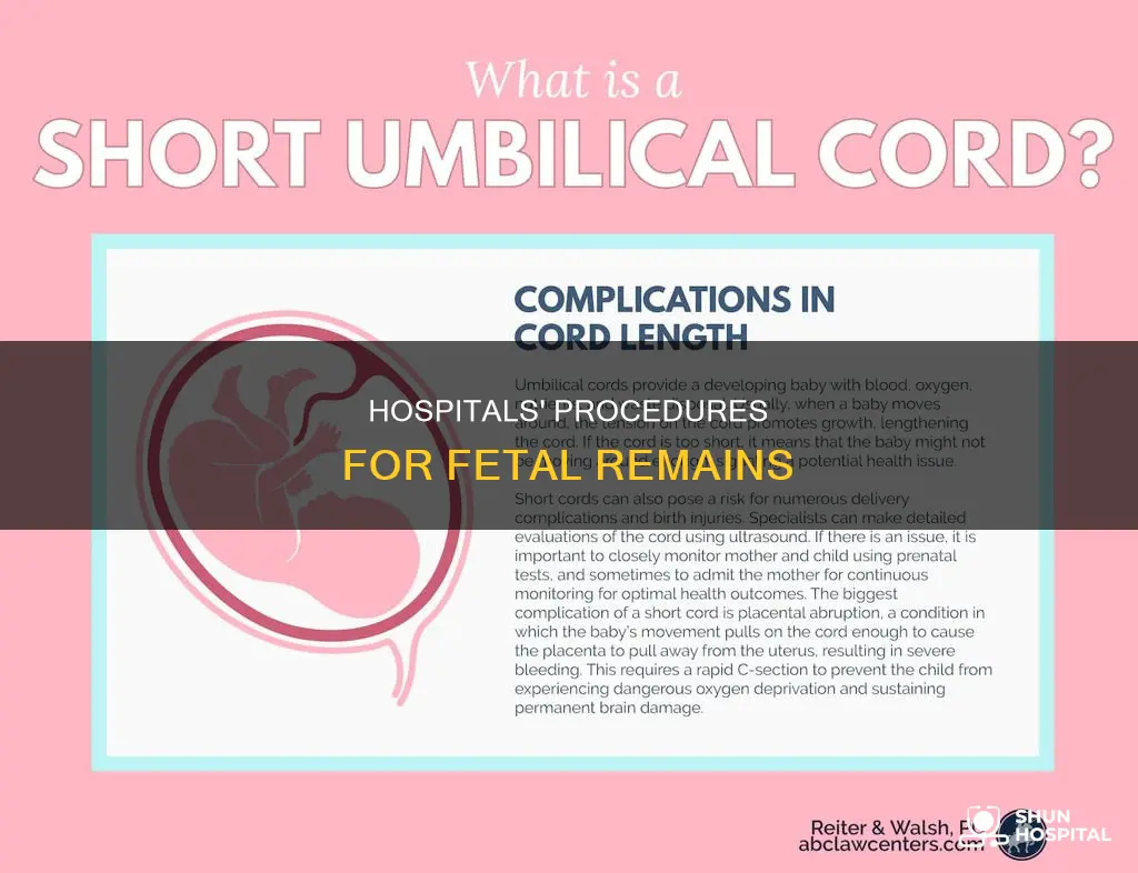 what do hospitals do with dead fetus