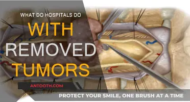 How Hospitals Handle Removed Tumors