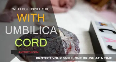 Umbilical Cord Processing: Hospitals' Post-Birth Procedures