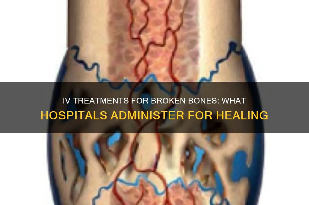 what do hospitals give people for broken bones iv