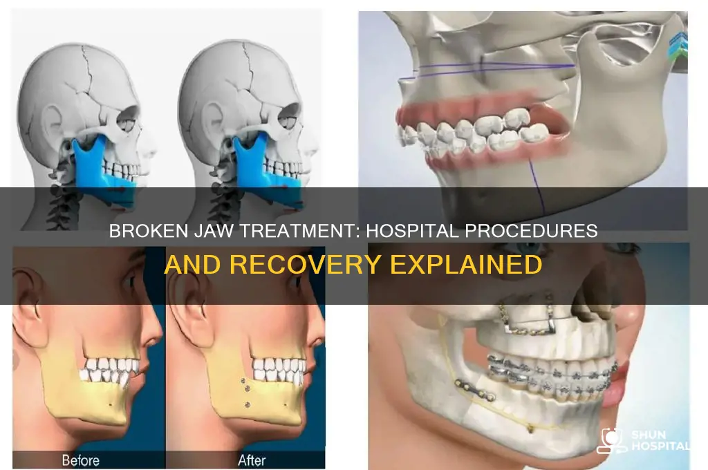 what do the hospital do for a broken jaw
