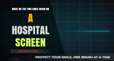 Decoding Hospital Monitors: Understanding the Purpose of Dual Lines on Screens